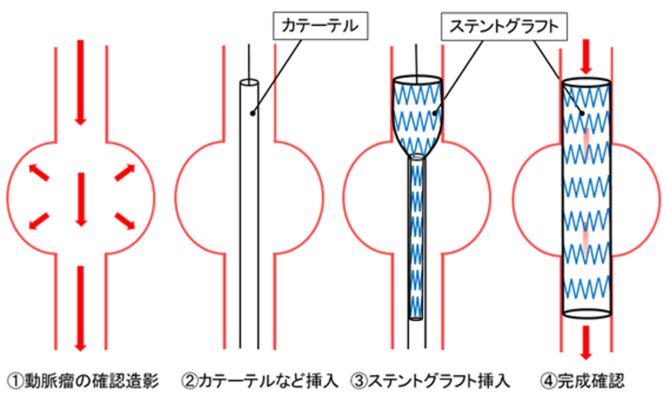 手術の内容